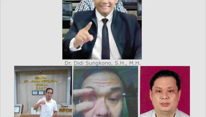 Operasi Mata Dokter RSMM Jatim ke Meja Hukum